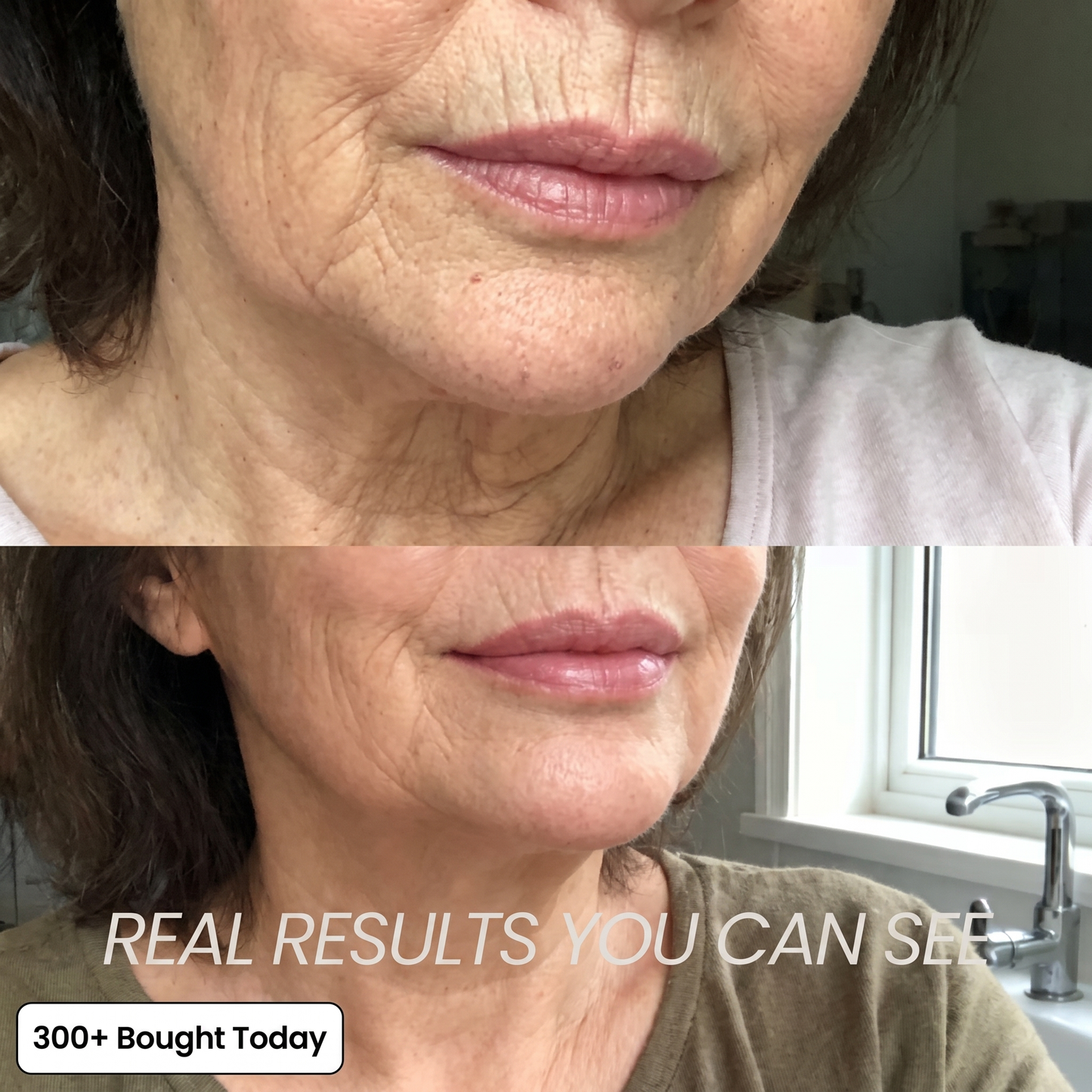 Navora™ PDRN Collagen Plump & Repair Balm
