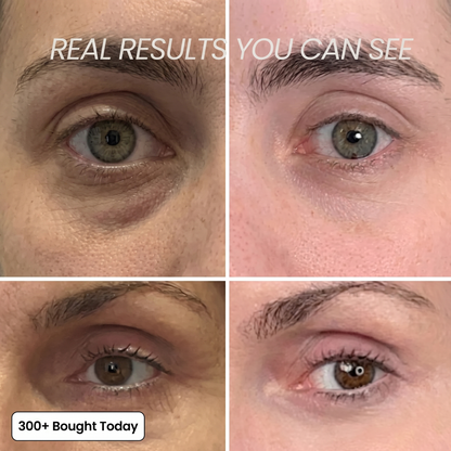 Navora™ PDRN Collagen Plump & Repair Balm