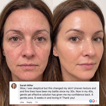 Navora™ PDRN Collagen Plump & Repair Balm