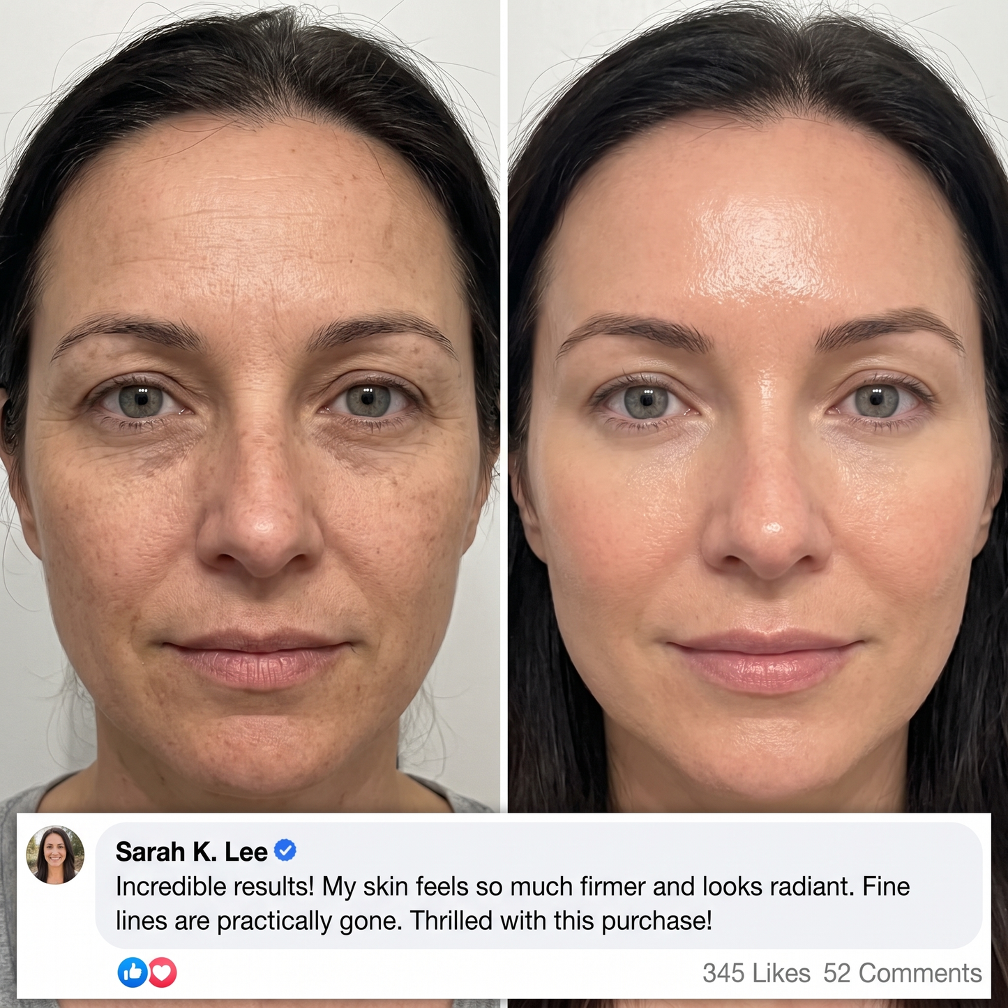 Navora™ PDRN Collagen Plump & Repair Balm
