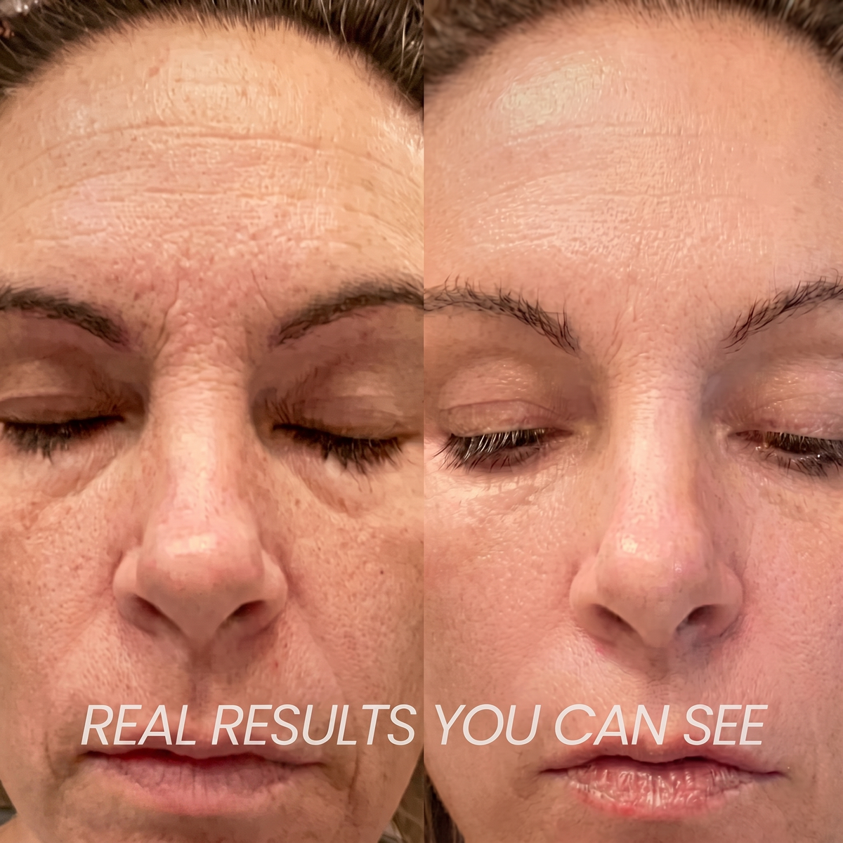 Navora™ PDRN Collagen Plump & Repair Balm